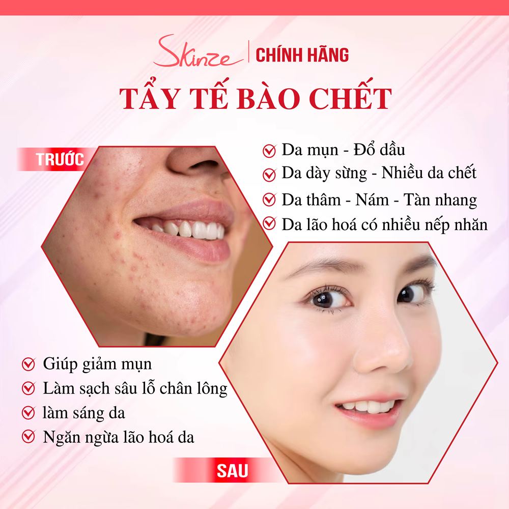 Tẩy da chết Skinze Peeling Scrub với BHA AHA Azelaic acid và Glycerin cho tẩy tế bào chết trên khuôn mặt và toàn thân