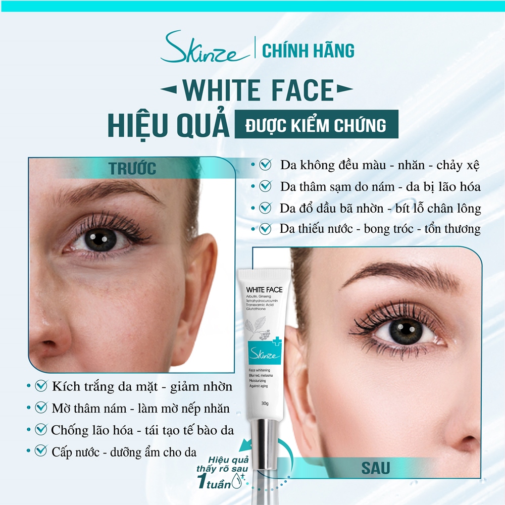 Kem dưỡng trắng da mặt Skinze White Face chống lão hóa và làm mờ thâm nám với các thành phần như Alpha Arbutin Nhân sâm BHA Retinol Glutathione và B5