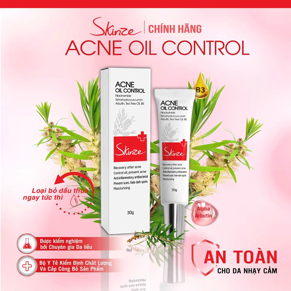 Kem dưỡng da dầu mụn Skinze Acne Oil Control - Giải pháp kiềm dầu ngừa mụn giảm thâm và làm trắng da đồng thời dưỡng ẩm