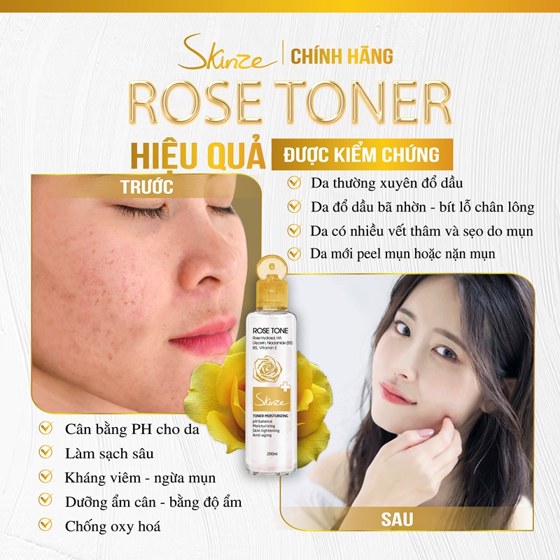 Nước hoa hồng Toner Skinze Moisturizing dành cho da khô và da thường